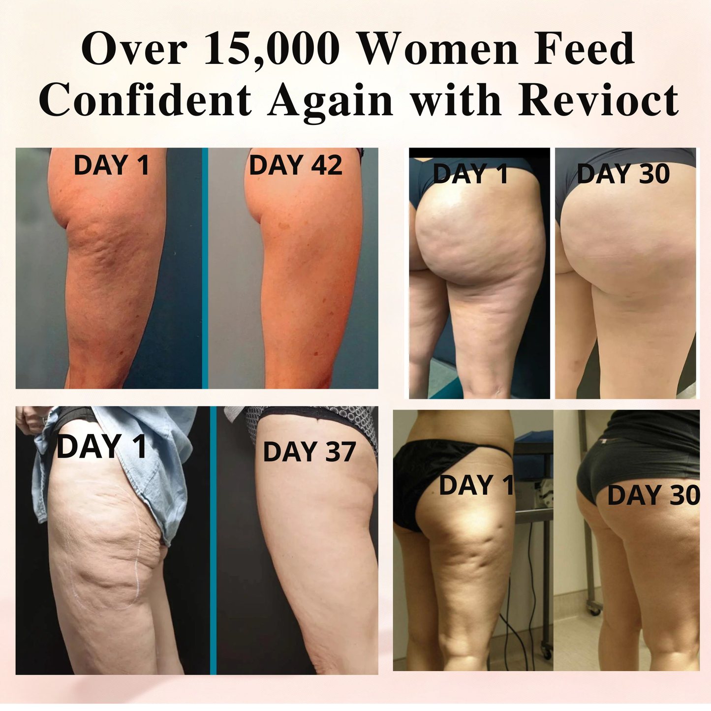 Revioct™ Cellulite Massager